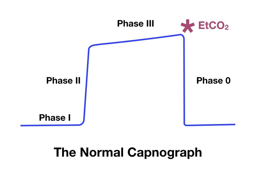 capnograph.001